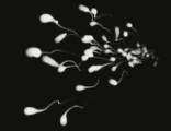 Thumbnail for: Spermticular